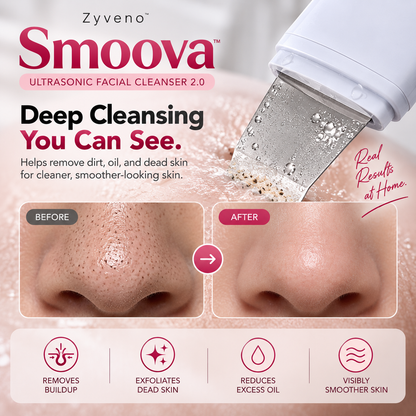 Smoova™ — Ultrasonic Facial Cleanser 2.0