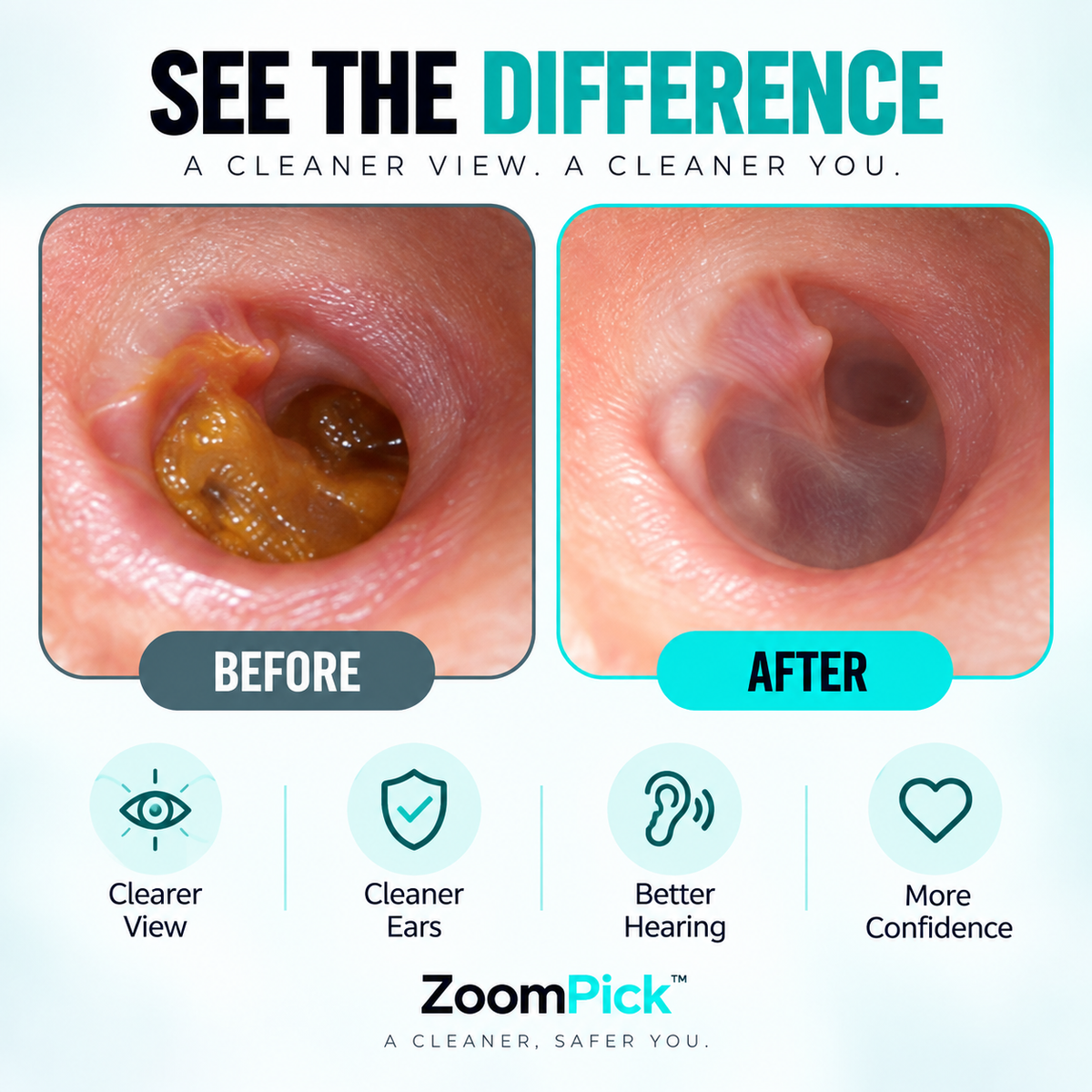 ZoomPick™ — HD Camera Ear Cleaner 2.0