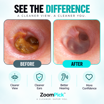 ZoomPick™ — HD Camera Ear Cleaner 2.0